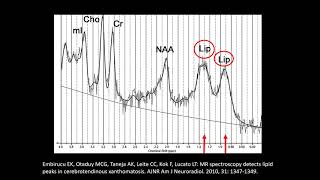 MR Spectroscopy in Neuroimaging [upl. by Berkley]