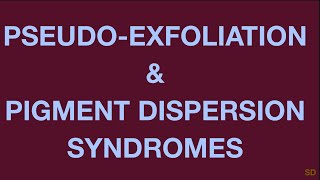 Glaucoma Session 15 Secondary Open Angle Glaucoma Part 1 Pseudoexfoliation Pigmentary [upl. by Karb]