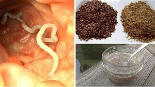 intestinal parasites  10 Warning and 7 Foods That Can Help Kill Them [upl. by Shannan]