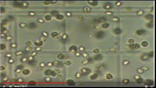 How to count Rbcs amp Wbcs content using Hemocytometer [upl. by Procora9]