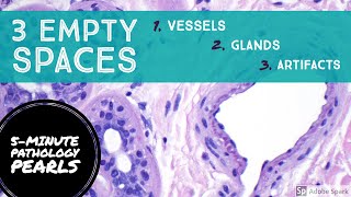 Skin Histology Blood Vessel vs Gland vs Artifact 5Minute Pathology Pearls [upl. by Zosima966]