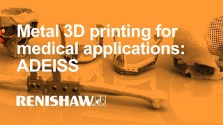 Metal 3D printing for medical applications ADEISS [upl. by Thorbert]