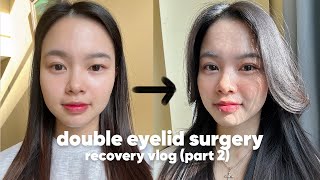 DOUBLE EYELID SURGERY RECOVERY VLOG PART 2  Braun Plastic Surgery South Korea 🇰🇷 [upl. by Trumann]