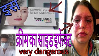 Medisalic cream side effectsमेडीसेलिक क्रीम का इस्तेमाल करने का सही तरीका [upl. by Elsa532]