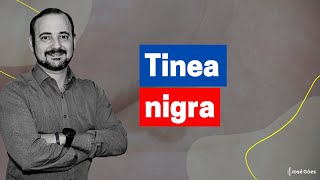 Tinea nigra  José Góes [upl. by Nylrats]