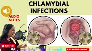 Chlamydia Infections Causes Symptoms and Treatment Options Audio Notes [upl. by Nylarak]