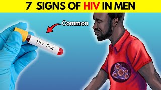 Signs of HIV in Men Early  How Do You Know if a Guy Has HIV [upl. by Kandace169]