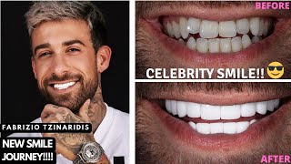 FABRIZIO TZINARIDIS GOT HIS TEETH DONE IN TURKEY  DENTAL TEAM TURKEY  VENEERS COST  VLOG [upl. by Winer]