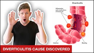 The ULTIMATE Diverticulitis Treatment Plan  4 Simple Steps [upl. by Bearnard781]