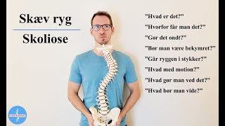 Hvad er en skæv ryg skoliose [upl. by Tennaj]