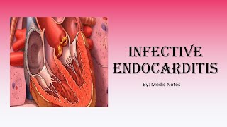 Cardiology Infective endocarditis  Dukes criteria Osler nodes Janeway lesions Roth spots [upl. by Namyw]