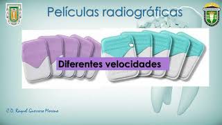 INTRODUCCIÓN A LA RADIOLOGÍA BUCAL [upl. by Napas]