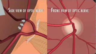 Optic Nerve Fibers [upl. by Dragone]