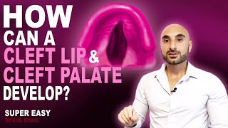 Living with Cleft Lip and Palate  The Doctors [upl. by Alleul]