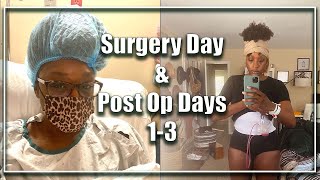 Video Title Extended Tummy Tuck Surgery Day  Post Op Days 13  Muscle Repair amp Lipo [upl. by Wrigley276]