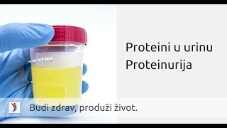 Proteini u urinu mokraći • Proteinurija [upl. by Dar]