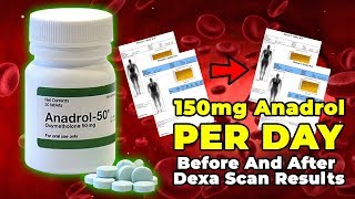 150 mg Anadrol PER DAY Before And After Dexa Scan Results [upl. by Wobniar636]