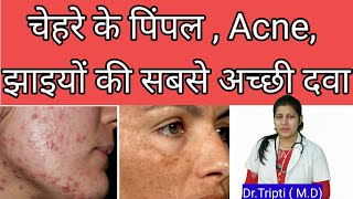 Berberis aquifoliumMedicine for acnepigmentationscars berberisaquifolium shorts acne  pimple [upl. by Alieka]