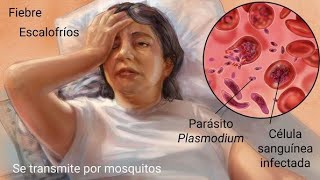 Que es el Paludismo o la Malaria Síntomas Diagnóstico Tratamiento y Prevención [upl. by Imeka]