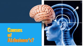 Whats REALLY Causing ALZHEIMERS Disease [upl. by Enitsahc]