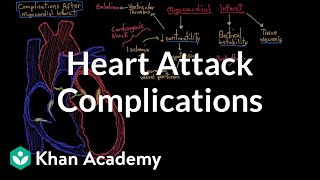 Complications after a heart attack myocardial infarction  NCLEXRN  Khan Academy [upl. by Bever622]