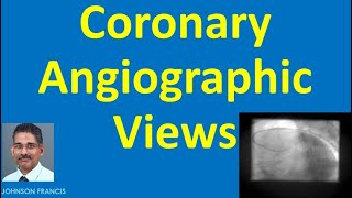 Coronary Angiographic Views [upl. by Cheney]