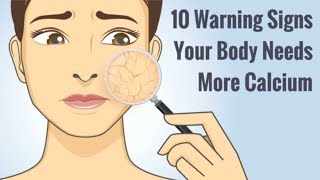 10 Warning Signs Your Body Needs More Calcium  Low Calcium Symptoms [upl. by Lauri]