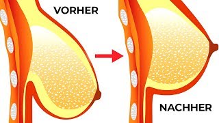 5 effektive Möglichkeiten für einen schönen Busen und ein straffes Dekollete [upl. by Melitta]