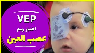 شرح اختبار رسم عصب العين Visual evoked potential test [upl. by Ileek]