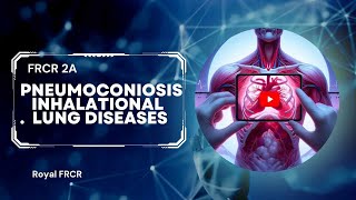 8  Chest Imaging for FRCR [upl. by Deuno793]