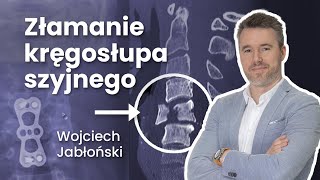 Złamanie kręgosłupa szyjnego  22 Radiologia [upl. by Winna291]