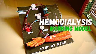 Hemodialysis working model  biology project science schoolproject medical  Nakul Sahu Art [upl. by Gaspard181]