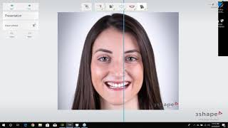 Webinar Smile Design in 3Shape An Overview with Brandon Smith CDT [upl. by Hoxsie]