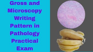 Writing pattern of Microscopy and Gross features in Pathology Practical Exam Approach to Patho OSPE [upl. by Ericksen]