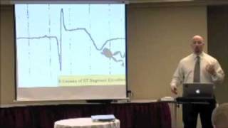 The 6 Causes ST Segment Elevation on an EKG ECG [upl. by Sibeal]