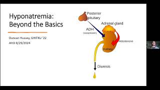 Hyponatremia D Hussey [upl. by Ahsiemal]