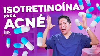 ISOTRETINOÍNA PARA ACNÉ  DERMATÓLOGO OPINA [upl. by Shelly]