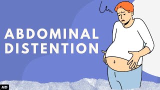 Abdominal Distention Everything You Need To Know [upl. by Dupuy]