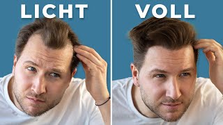 GEHEIMRATSECKEN IM NU KASCHIEREN ● HAARSTYLING TUTORIAL für LICHTES HAAR [upl. by Nyrol465]