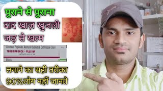 Terbinaforce plus nf cream use benefits and Side effects full review in hindi [upl. by Emarej776]