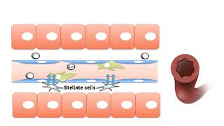 PORTAL HYPERTENSION EXPLAINED Hepatic portal vein hypertension explained [upl. by Akimed]