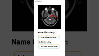 Take a look at this image—can you name the artery that’s highlighted medicalquiz radiologybuzz [upl. by Zsa]