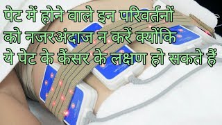 पेट के कैंसर के लक्षणpet ke cancer ke lakshanstomach cancer symptoms [upl. by Smitty109]