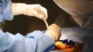 Vertebroplasty Live Procedure Hussien ElMaghraby [upl. by Masterson]