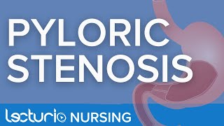 Pyloric Stenosis [upl. by Serrell]