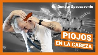 PIOJOS en la CABEZA  10 MITOS Y VERDADES sobre la PEDICULOSIS [upl. by Fitzhugh]