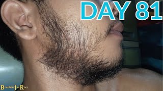 DAY 81  KIRKLAND MINOXIDIL BEARD JOURNEY [upl. by Sower]