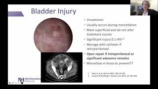 ANIMATION  Holmium Laser Enucleation of the Prostate HoLEP – „3 horseshoe technique“ [upl. by Ambrosine]