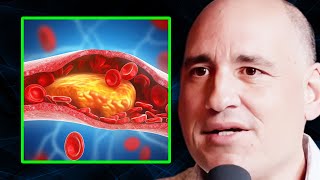 Heart Surgeon You’ve Been LIED TO About Cholesterol amp Heart Disease  Dr Philip Ovadia [upl. by Atirehs]