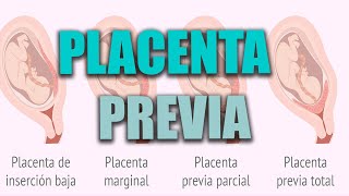 PLACENTA PREVIA en el embarazo placenta baja ¿Qué es ¿Cómo afecta al parto la placenta previa [upl. by Anom381]